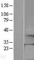 GTP cyclohydrolase 1 (GCH1) Human Over-expression Lysate