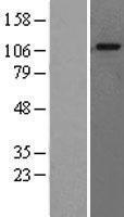 GAA Human Over-expression Lysate