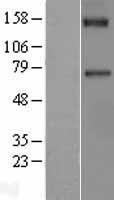 Factor XI (F11) Human Over-expression Lysate