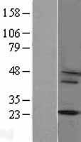CYBA Human Over-expression Lysate