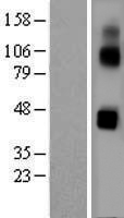 CLN3 Human Over-expression Lysate