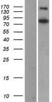 Collagen III (COL3A1) Human Over-expression Lysate