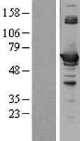CBS Human Over-expression Lysate