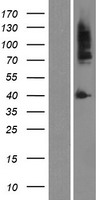 Androgen Receptor (AR) Human Over-expression Lysate