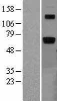 ARSB Human Over-expression Lysate