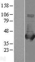 ALDOB Human Over-expression Lysate