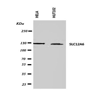 SLC12A6 Rabbit Polyclonal Antibody
