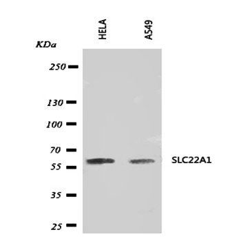 SLC22A1 Antibody