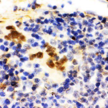 Anti-FLI1 Antibody