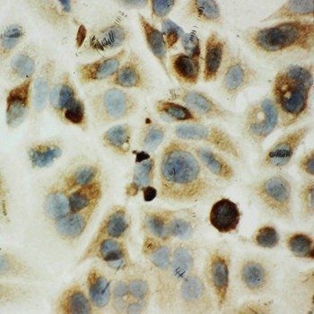 Anti-Hyaluronidase-1 HYAL1 Antibody