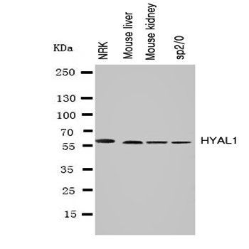 Anti-Hyaluronidase-1 HYAL1 Antibody