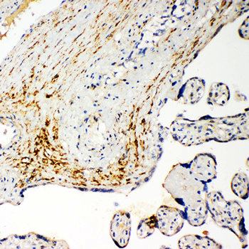 Monocarboxylate transporter 5 SLC16A4 Antibody