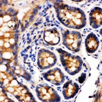 Anti-Integrin alpha 1/ITGA1 Antibody