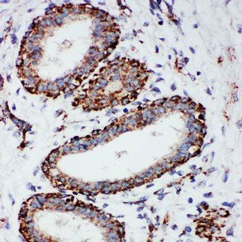 Anti-MTCO1/MT-CO1 Antibody