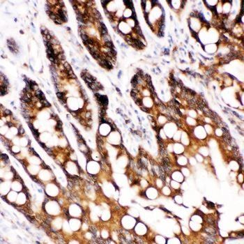 Anti-Caspase-6(P18)/CASP6 Antibody