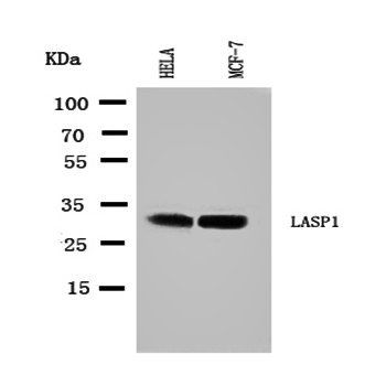 LIM and SH3 domain protein 1 LASP1 Antibody