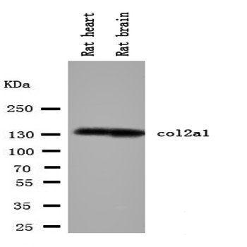 Collagen II/COL2A1 Antibody