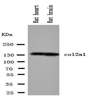 Anti-Collagen II/COL2A1 Antibody