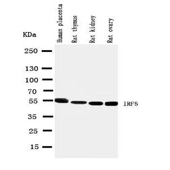 Anti-Interferon regulatory factor 5 IRF5 Antibody