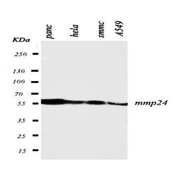 Anti-Matrix metalloproteinase-24 MMP24 Antibody