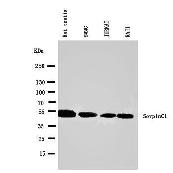 Anti-Antithrombin III/SERPINC1 Antibody