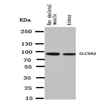 Sodium/hydrogen exchanger 2 SLC9A2 Antibody