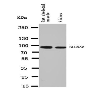 Anti-Sodium/hydrogen exchanger 2 SLC9A2 Antibody