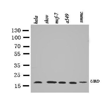Diubiquitin/UBD Antibody
