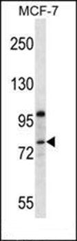 PR15B antibody
