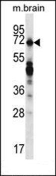 REPS2 antibody