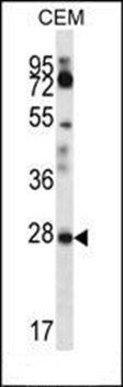 RARRES1 antibody