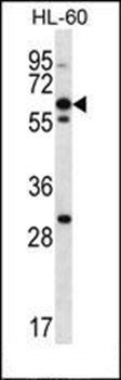 NPTXR antibody