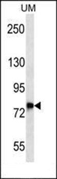 DNAJC14 antibody