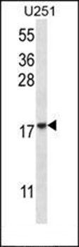 EIF1AY antibody