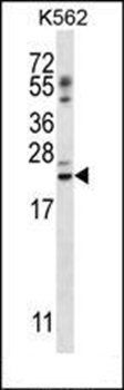 PSORS1C1 antibody