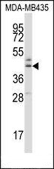 B3GNT1 antibody