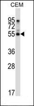 PALMD antibody