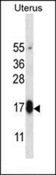 GPHB5 antibody