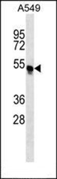 TRIM54 antibody