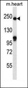 SLIT1 antibody