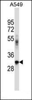 BNIP2 antibody