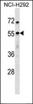 USP27X antibody