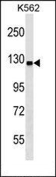 UBA6 antibody