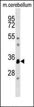 DUSP12 antibody