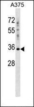 PSG2 antibody