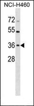 HUS1 antibody