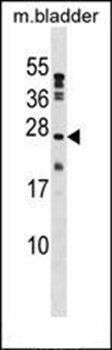 PTP4A1 antibody