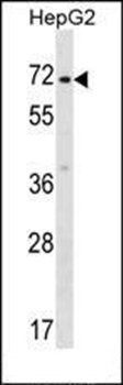 ZNF155 antibody