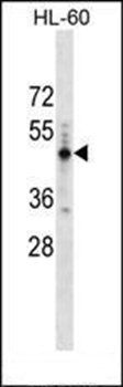 PRAMEF14 antibody
