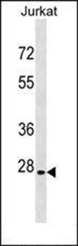 ANP32B antibody
